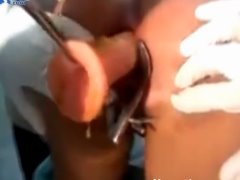 Médicos retirando pênis de borracha de dentro da bunda da mulher